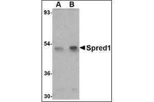 Western blot analysis of Spred1 in mouse brain tissue lysate with this product at (A) 1 and (B) 2 μg/ml. (SPRED1 抗体  (Center))