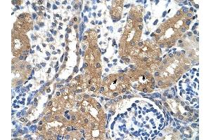 Immunohistochemistry (IHC) image for anti-Cytochrome P450, Family 4, Subfamily A, Polypeptide 22 (CYP4A22) (N-Term) antibody (ABIN635097)