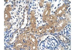 CYP4A22 antibody was used for immunohistochemistry at a concentration of 4-8 ug/ml to stain Epithelial cells of renal tubule (arrows) in Human Kidney. (CYP4A22 抗体  (N-Term))