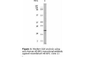 Image no. 1 for anti-Eukaryotic Translation Initiation Factor 4E Binding Protein 1 (EIF4EBP1) antibody (ABIN207632) (eIF4EBP1 抗体)