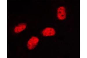 Immunofluorescence (fixed cells) (IF/ICC) image for anti-Sp1 Transcription Factor (SP1) (pThr453) antibody (ABIN6256566)