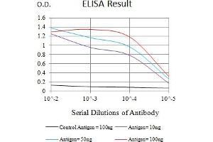 Black line: Control Antigen (100 ng),Purple line: Antigen (10 ng), Blue line: Antigen (50 ng), Red line:Antigen (100 ng) (IL10RB 抗体  (AA 20-220))
