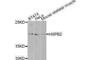 Western blot analysis of extracts of various cell lines, using HSPB2 antibody (ABIN5971309) at 1/1000 dilution. (HSPB2 抗体)