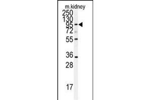 Western blot analysis of anti-AD Antibody (N-term) (ABIN391640 and ABIN2841551) in mouse kidney tissue lysates (35 μg/lane). (ADAM9 抗体  (N-Term))