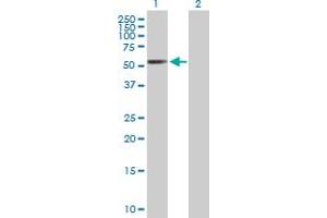 Western Blot analysis of RARB expression in transfected 293T cell line by RARB MaxPab polyclonal antibody. (Retinoic Acid Receptor beta 抗体  (AA 1-448))