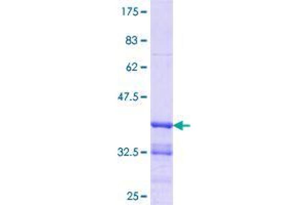 ZBTB7B Protein (AA 433-537) (GST tag)