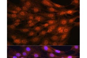 Immunofluorescence analysis of C6 cells using YAP1 Polyclonal Antibody at dilution of 1:100. (YAP1 抗体)