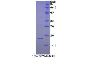 SDS-PAGE analysis of Rat RBP2 Protein.