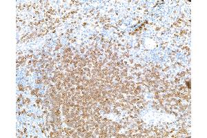 Immunohistochemistry (IHC) image for anti-CD3 epsilon (CD3E) (AA 139-189) antibody (ABIN7454000)