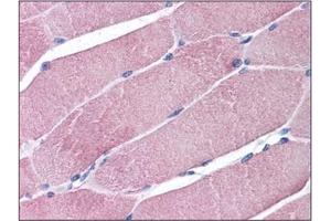Human Skeletal Muscle: Formalin-Fixed, Paraffin-Embedded (FFPE) (TRIM7 抗体  (C-Term))