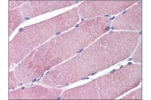 Human Skeletal Muscle: Formalin-Fixed, Paraffin-Embedded (FFPE) (TRIM7 抗体  (C-Term))