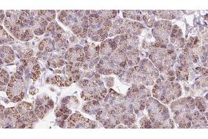 ABIN6273237 at 1/100 staining Human pancreas cancer tissue by IHC-P. (EIF3I 抗体  (C-Term))