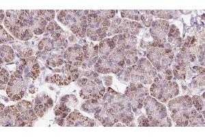 ABIN6273237 at 1/100 staining Human pancreas cancer tissue by IHC-P. (EIF3I 抗体  (C-Term))