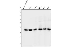 Western blot analysis of NMI using anti-NMI antibody (ABIN3043451).