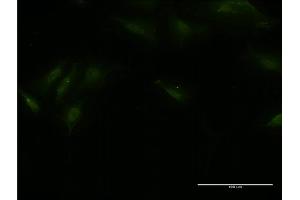 Immunofluorescence of monoclonal antibody to BTBD9 on HeLa cell. (BTBD9 抗体  (AA 2-70))