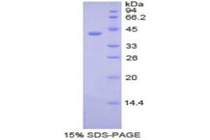 SDS-PAGE (SDS) image for Cholecystokinin (CCK) (AA 1-115) protein (His tag,GST tag) (ABIN1821623) (Cholecystokinin Protein (CCK) (AA 1-115) (His tag,GST tag))