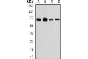 Western blot analysis of Int11 expression in SKOV3 (A), MCF7 (B), mouse spleen (C), rat liver (D) whole cell lysates. (CPSF3L 抗体)