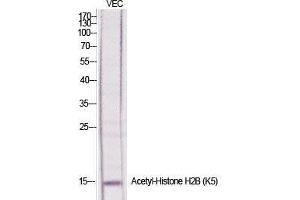 Western Blot (WB) analysis of specific cells using Acetyl-Histone H2B (K5) Polyclonal Antibody. (Histone H2B 抗体  (acLys5))