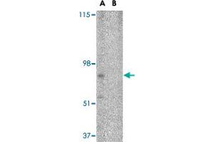 Western blot analysis of BRE in HeLa cell lysate in (A) the absence and (B) presence of blocking peptide with BRE polyclonal antibody  at 1 ug/mL . (BRE 抗体  (N-Term))
