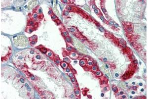 Kidney, Human: Formalin-Fixed, Paraffin-Embedded (FFPE) (Cytokeratin 18 抗体)