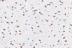Immunohistochemistry analysis of paraffin-embedded rat substantia nigra using Ring1A (ABIN7075467) at dilution of 1: 3600 (RING1 抗体)