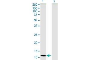 Western Blot analysis of SLC22A18AS expression in transfected 293T cell line by SLC22A18AS monoclonal antibody (M05), clone 4B1. (SLC22A18AS 抗体  (AA 1-150))