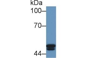 Western Blotting (WB) image for anti-Proteasome (Prosome, Macropain) 26S Subunit, ATPase, 4 (PSMC4) (AA 1-418) antibody (ABIN7442066)