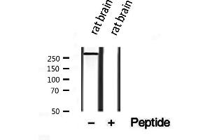 Western blot analysis of extracts from rat brain, using Piezo1 antibody. (PIEZO1 抗体  (Internal Region))