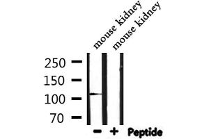 Western blot analysis of extracts from mouse kidney, using IGHMBP2 Antibody. (IGHMBP2 抗体  (Internal Region))