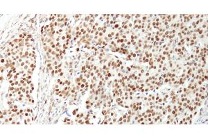 anti-Nuclear Casein Kinase and Cyclin-Dependent Kinase Substrate 1 (NUCKS1) (AA 1-50) antibody