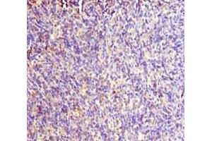 Immunohistochemistry of paraffin-embedded human thymus tissue using ABIN7167019 at dilution of 1:100 (RACGAP1 抗体  (AA 353-632))