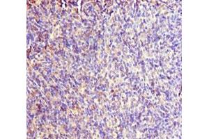 Immunohistochemistry of paraffin-embedded human thymus tissue using ABIN7167019 at dilution of 1:100 (RACGAP1 抗体  (AA 353-632))