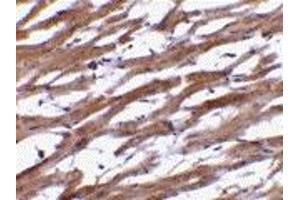 Immunohistochemistry (IHC) image for anti-B-Cell Receptor-Associated Protein 29 (BCAP29) (Middle Region) antibody (ABIN1030880) (BCAP29 抗体  (Middle Region))