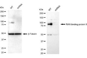 Western blotting analysis using RAN binding protein 9 antibody (ABIN7799025). (Recombinant Importin 9 抗体)