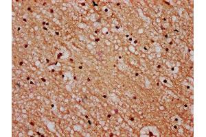 IHC image of ABIN7168574 diluted at 1:600 and staining in paraffin-embedded human brain tissue performed on a Leica BondTM system. (STH 抗体  (AA 1-128))