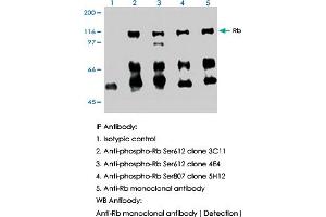 IP-Western blotting in HL-60 cell lysate using RB1 (phospho S612) monoclonal antibody, clone 3C11 (Cat # MAB0003 ; Lane 2). (Retinoblastoma 1 抗体  (pSer612))