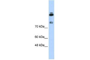 WB Suggested Anti-HDLBP Antibody Titration:  0. (HDLBP 抗体  (N-Term))