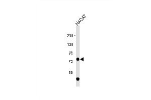 Anti-TP63 Antibody (C-term) at 1:1000 dilution + HACAT whole cell lysate Lysates/proteins at 20 μg per lane. (p63 抗体  (C-Term))