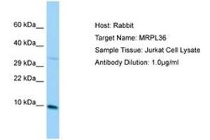 Image no. 1 for anti-BRCA1 Interacting Protein C-terminal Helicase 1 (BRIP1) (C-Term) antibody (ABIN6750116) (BRIP1 抗体  (C-Term))