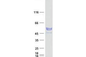 Validation with Western Blot