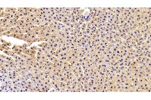 Detection of FASN in Rat Liver Tissue using Polyclonal Antibody to Fatty Acid Synthase (FASN) (Fatty Acid Synthase 抗体  (AA 2263-2512))