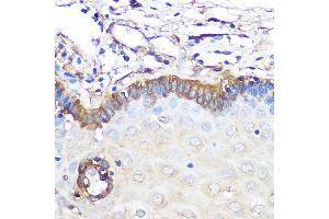 Immunohistochemistry of paraffin-embedded human esophageal using Ferritin Light Chain Rabbit mAb (ABIN7267170) at dilution of 1:100 (40x lens). (FTL 抗体)
