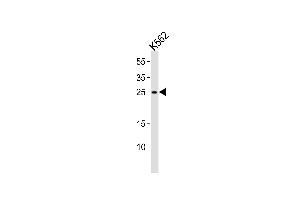 Western blot analysis of lysate from K562 cell line, using RAB27A Antibody (C-term) (ABIN1881720 and ABIN2839093).