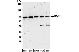 anti-2-Hydroxyacyl-CoA Lyase 1 (HACL1) (AA 528-578) antibody