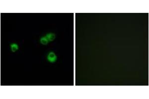 Immunofluorescence analysis of MCF-7 cells, using OR7E5P Antibody. (OR7E5P 抗体  (AA 35-84))