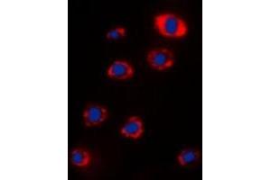 Immunofluorescent analysis of RPS12 staining in Hela cells. (RPS12 抗体  (C-Term))