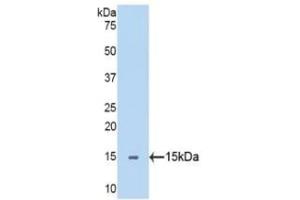 Detection of Recombinant SEMA5B, Human using Polyclonal Antibody to Semaphorin 5B (SEMA5B) (SEMA5B 抗体  (AA 36-161))