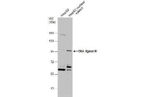 WB Image HepG2 whole cell and nuclear extracts (30 μg) were separated by 7. (LIG3 抗体  (C-Term))