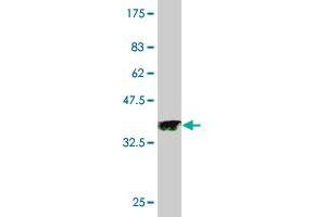 Western Blot detection against Immunogen (35. (PAK3 抗体  (AA 1-90))