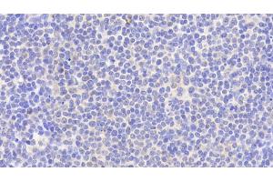 Immunohistochemistry (IHC) image for anti-Tyrosine-Protein Phosphatase Non-Receptor Type 22 (PTPN22) (AA 1-233) antibody (ABIN7444976)
